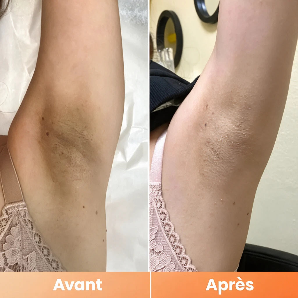 Peel Shot — Spray Exfoliant Kojic Acid + Curcuma