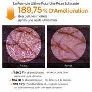 Peel Shot — Spray Exfoliant Kojic Acid + Curcuma
