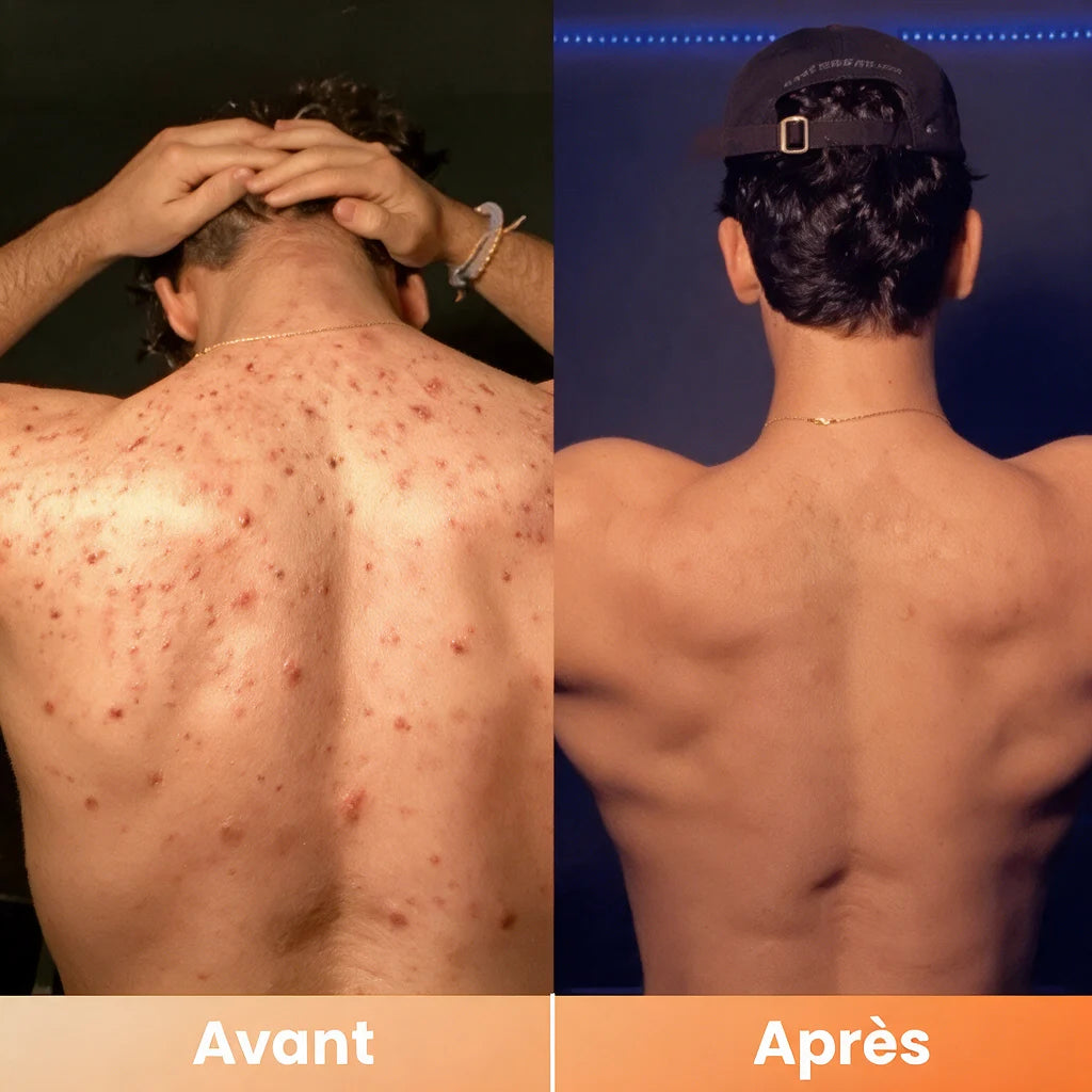 Peel Shot — Spray Exfoliant Kojic Acid + Curcuma