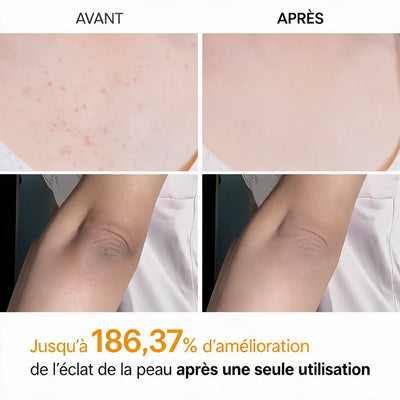 Peel Shot — Spray Exfoliant Kojic Acid + Curcuma