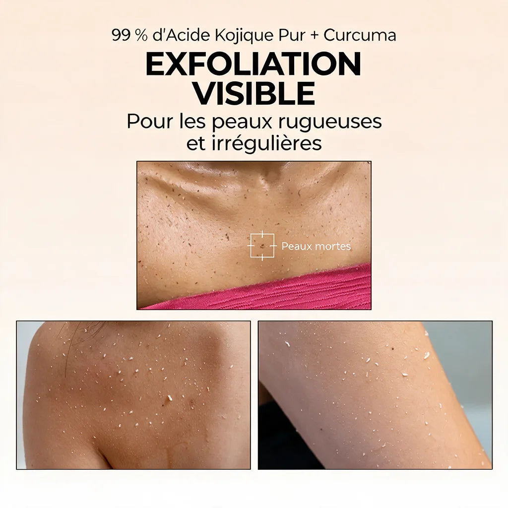 Peel Shot — Spray Exfoliant Kojic Acid + Curcuma