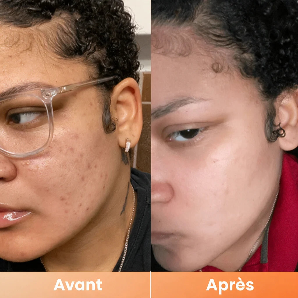 Peel Shot — Spray Exfoliant Kojic Acid + Curcuma