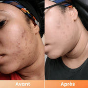 Peel Shot — Spray Exfoliant Kojic Acid + Curcuma