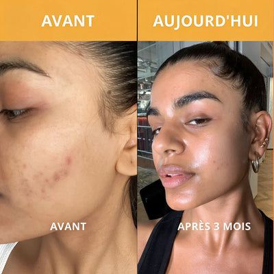 Peel Shot — Spray Exfoliant Kojic Acid + Curcuma
